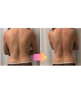 ケアラ(Care.A)/1回での変化