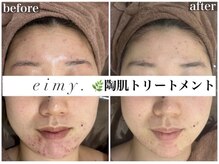 エイミー 名古屋駅前店(eimy.)/ララピール/名古屋