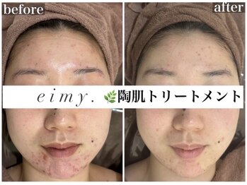 エイミー 名古屋駅前店(eimy.)/ララピール/名古屋