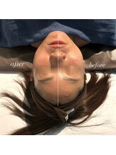 サロンエス 高田神楽店(SALON S)/韓国式小顔コルギ症例写真です♪