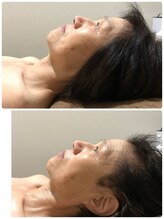 吉川美南ライフ整骨院/60代女性