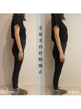 アール アンド ビューティーサロン(Ｒ＆ BeautySalon)/産後の骨盤矯正にはこれ！