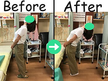 杉本接骨鍼灸院/腰痛があり、産後に悪化した