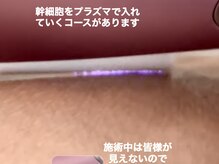 ティアラ(TIARA)/プラズマ