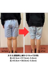 たかみや鍼灸接骨院/耳つぼ＋食事調整でダイエット