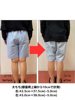 たかみや鍼灸接骨院/耳つぼ＋食事調整でダイエット