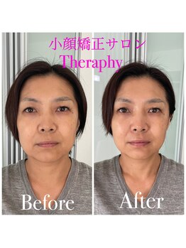 小顔矯正サロン セラフィ/1回でもたるみのない細い小顔へ