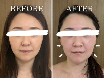 ヨサパーク サナ 二子玉川(YOSA PARK SANA)/肌トーンアップ↑