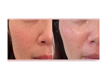 ミロク(369)/韓国肌管理