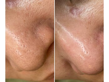 サイ(Sai)/before⇒after