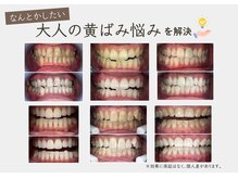 ブライト 八王子(bright)の雰囲気（はじめての方にも♪満足度の高い効果が実感できる本格美白ケア）