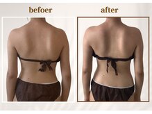 マーキュリー 乃木坂店(Mercury)/六本木/赤坂/乃木坂/リンパ/痩身