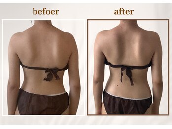 マーキュリー 乃木坂店(Mercury)/六本木/赤坂/乃木坂/リンパ/痩身