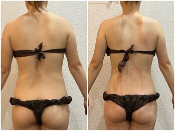 美容整体ウェリナ あま甚目寺院/小顔矯正/骨盤矯正/美脚サロン