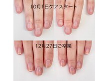 リバティー(liberty)の雰囲気（ケア習慣でここまで変わる。3ヶ月で健康的な美爪へ育成実感）