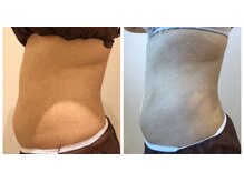 エイシスグロウ(asis glow.)/効果写真