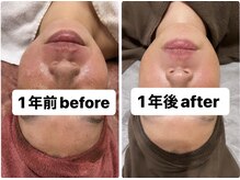 ブリリアント(Brilliant)/お悩み別メニューご提案します