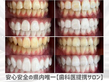 ベル 長岡店(Belle)