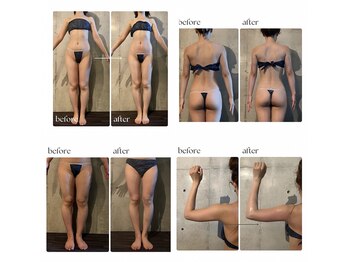 ボーレーヴ(beau reve)/痩身/インディバ/エンダモロジー