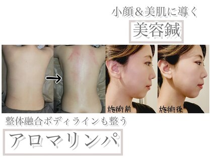 あくび 西麻布(aqu美)の写真