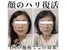 人気No,2【老け見え解消】フェイスライン集中ケア★若見え再生小顔矯正30分