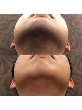 フェリーバ 浦和店(FELIVA)/Before&After