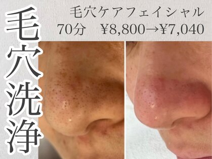 エースマイルイズ(A smile is..)の写真