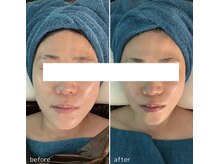 アンドワイ バイ サロンリーナ(&y by Salon Lena)の雰囲気（骨造が大人気！瞬時に小顔☆【大切なお客様の口コミもcheck】）