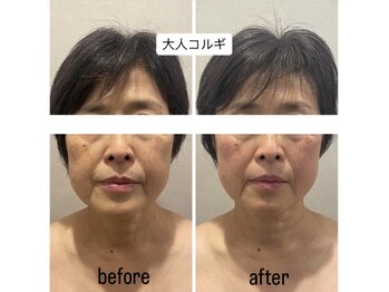 ラコル 京橋店(lacol)/【新メニュー】大人コルギ