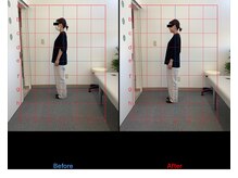 リード整骨院(LEAD整骨院)/姿勢改善、猫背、反り腰