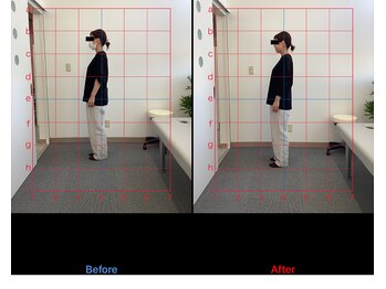 リード整骨院(LEAD整骨院)/姿勢改善、猫背、反り腰