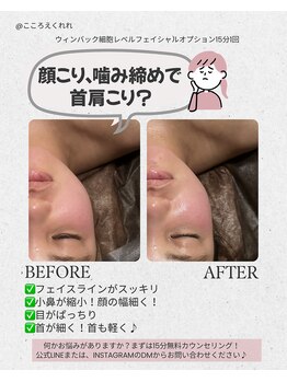 こころえくれれ/ウィンバック/WINBACK