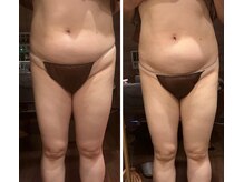 神楽坂のほぐし堂の雰囲気（見た目も軽さも変わる。体の巡りを整えるケア）