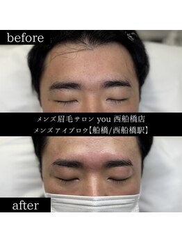 ユー 西船橋店(you)/ビフォーアフター写真