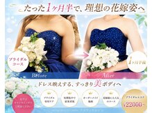プリヴィエレジェ(privilegie)