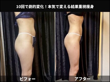 アスエ(ASUE)の写真