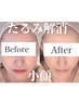 【1番人気】頭蓋骨＋デコルテ調整付き満足度◎小顔コルギコース60分11000円→