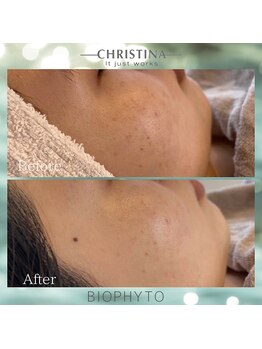 シグネット(Cygnet)/CHRISTINA/ビオフィート