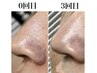 【眉毛とお鼻ケア】眉毛デザインWAX×鼻の強力毛穴洗浄 16000→13500