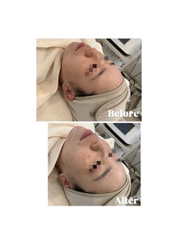 クリスタルグロウ 苫小牧大町店(Crystal Glow)/