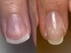 ロイヤル ビューティー サロン(Royal Beauty Saloon)の写真/本格自爪育成、深爪育成、ネイルケア、トラブル爪対応◎爪のお悩みを根本改善、健康に育てます*