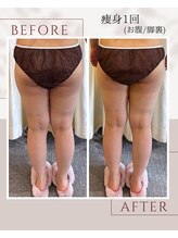 ペルラペティーユ(PERLA PETILLER)/脚裏