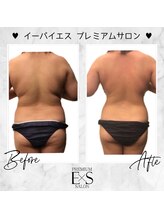 プライマルビューティ 艶 本店(Primal Beauty)/EｘS上半身　ビフォーアフター