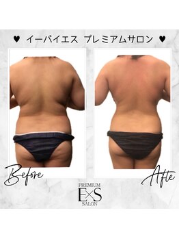 プライマルビューティ 艶 本店(Primal Beauty)/EｘS上半身　ビフォーアフター