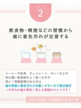 エクシアホワイトニング 阪急洛西口駅前店/白さを保つポイント