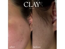 クレイ(CLAY)