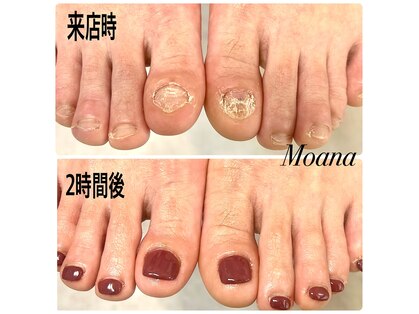 モアナ 池袋(MOANA)の写真