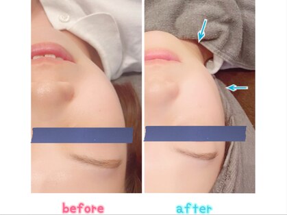 グービー(goovy)の写真