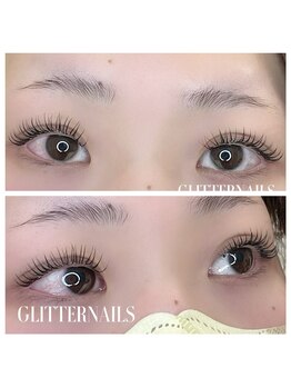 グリッターネイル(GLITTER NAILS)/アンドヘルシー