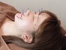 【２・３回目の方限定クーポン】美容鍼40分　5500円→5000円